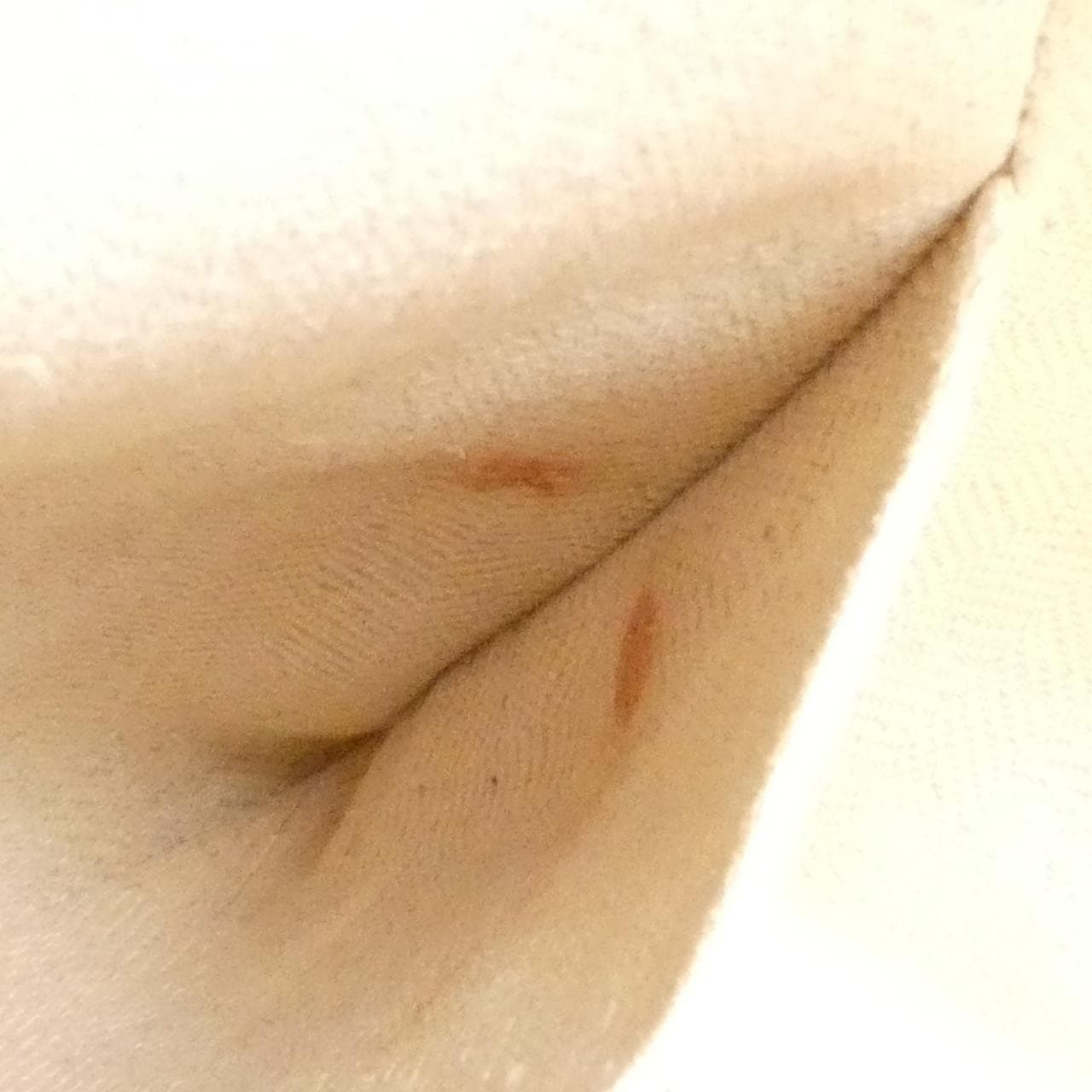 ロエベ ハンモック 写真10